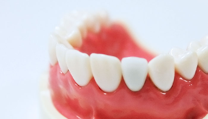 前歯の治療